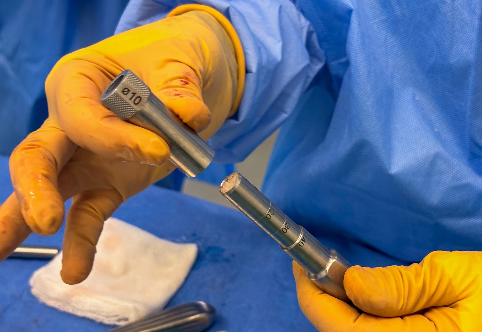 Close-up of graft-sizing instrument (&Oslash;10 mm, depth-marked)
