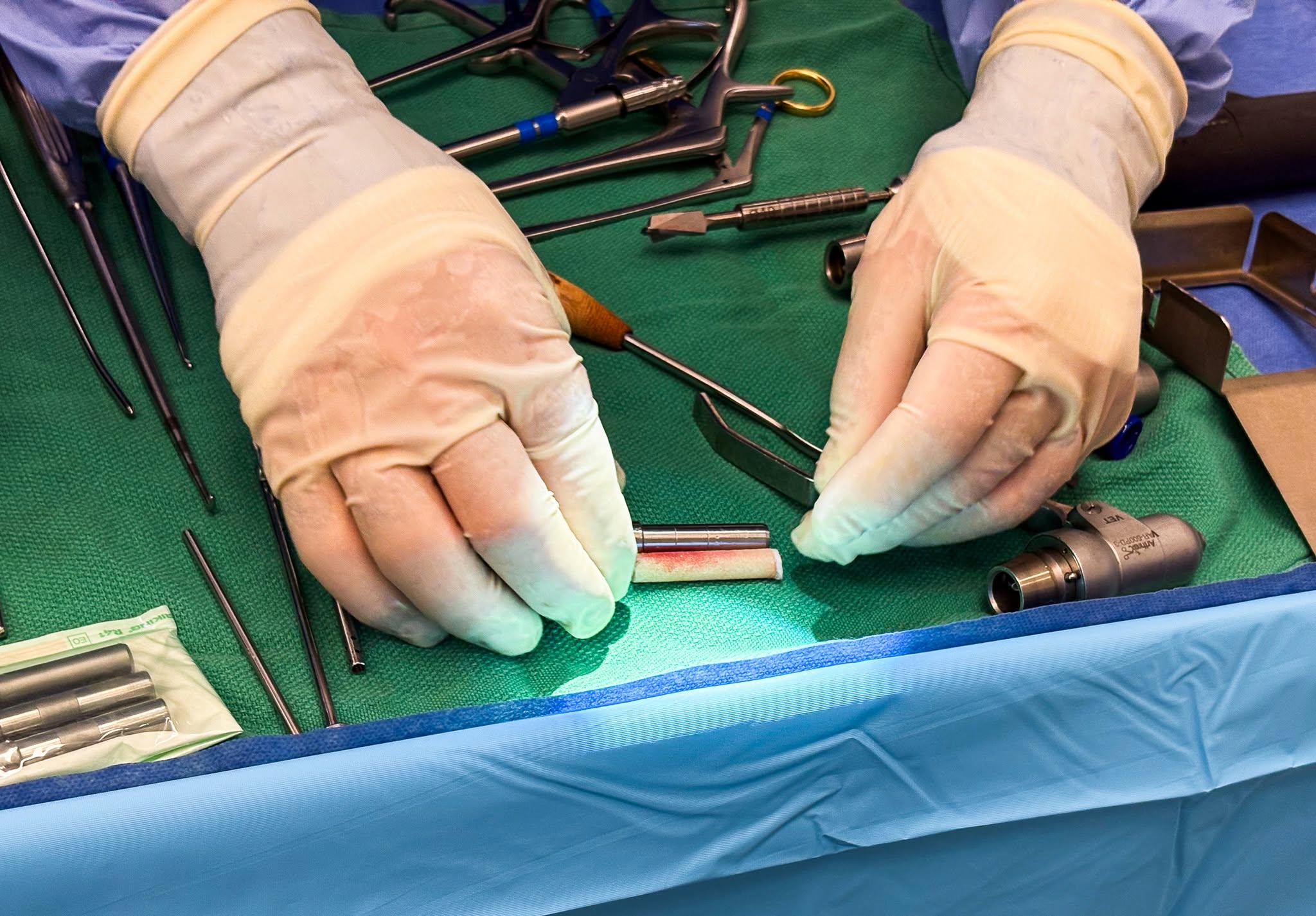 Gloved hands handling a harvested osteochondral graft